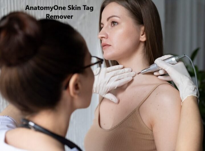 AnatomyOne Skin Tag Remover