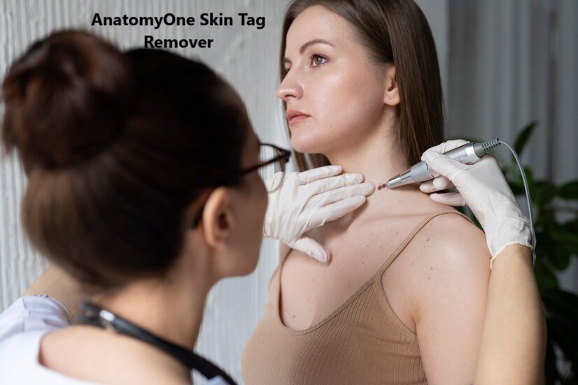 AnatomyOne Skin Tag Remover